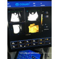 High end trolley type 4d color doppler with volume probe